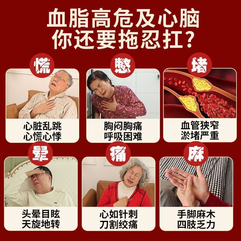 血中脂質低下を助ける扁鹊医師のロバーバームプロポリスソフトカプセル、扁鵲薬局公式旗艦店正規品富源ブランド|undefined