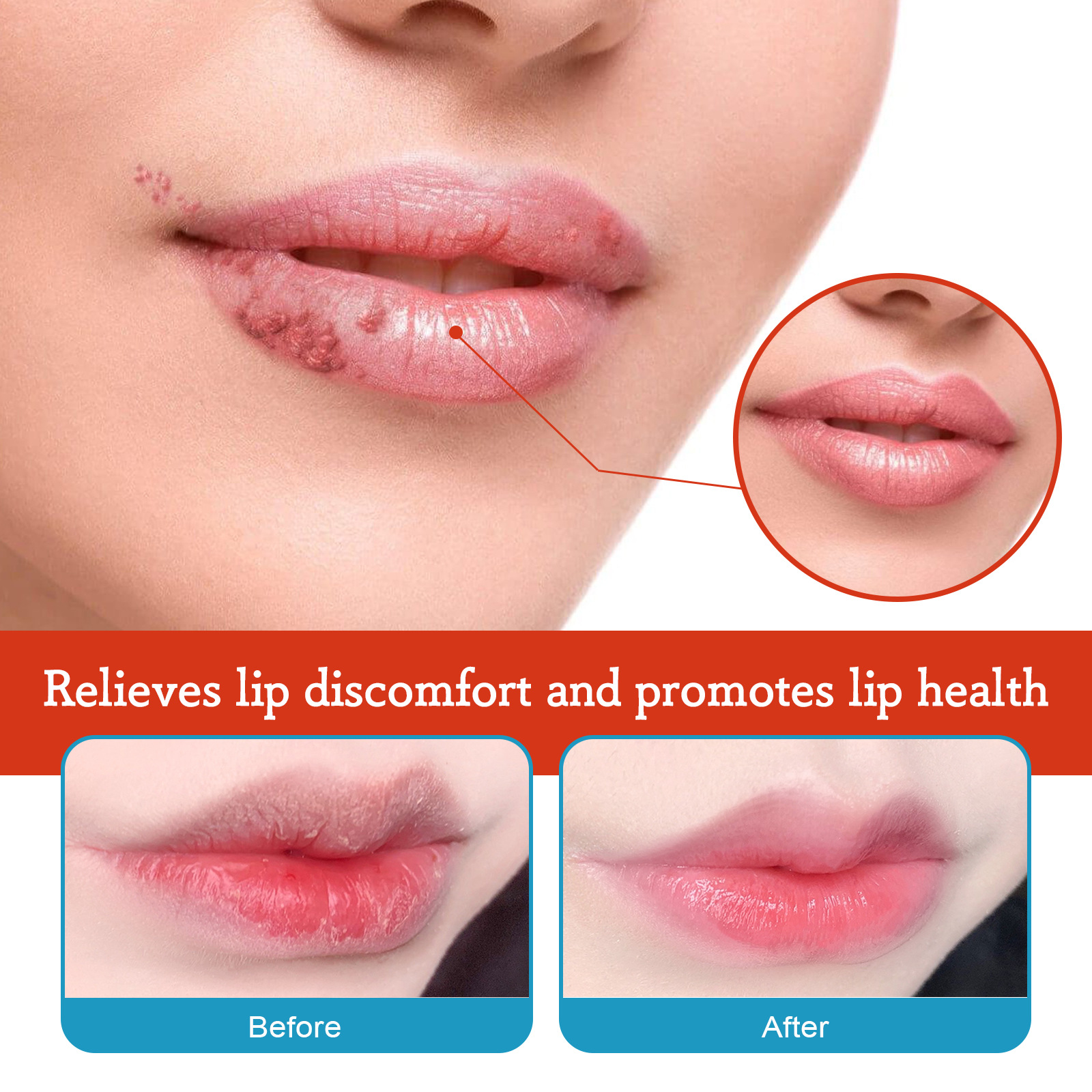 OUHOE Repair Moisturizing, Anti drying, Cracking, Removing Dead Skin, and Fading Lip Lines Care Cream_voghion.com