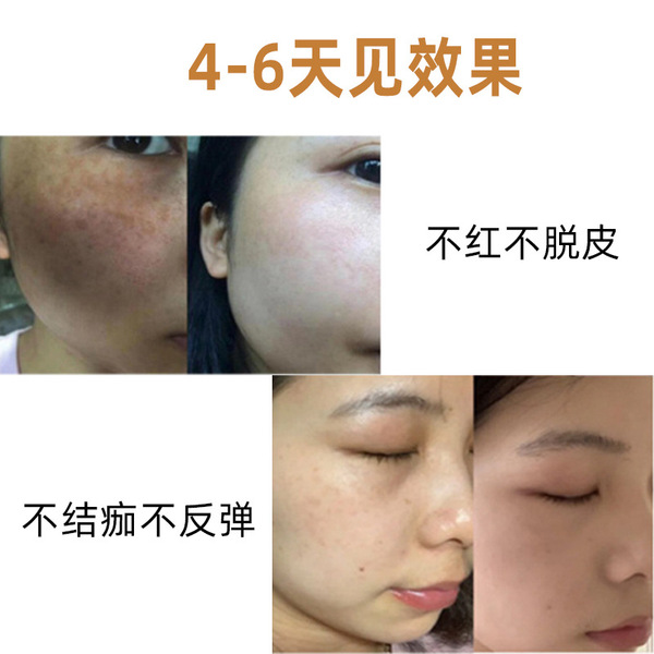 Moisturizing serum with ginseng