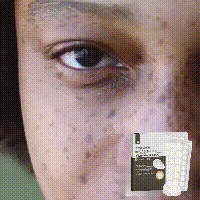 Plasture anti-iritații West&Month pentru a atenua roșeața, petele acneice, defectele gurii închise, acoperirea petelor, plasturi reparatori_voghion.com