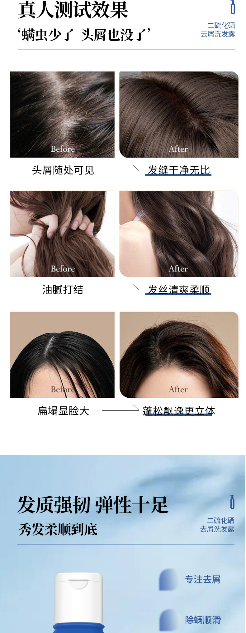 AOPY-二硫化硒去屑洗发露详情页_08.jpg