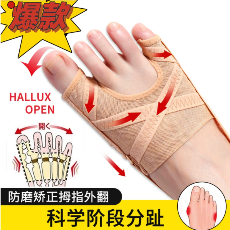 Большой палец выворачивается ортез