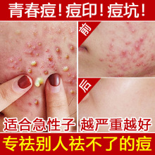 �ݱ�����AҺР���Ӷ�ӡ�ഺ���۴̸����沿�����տsë�����o