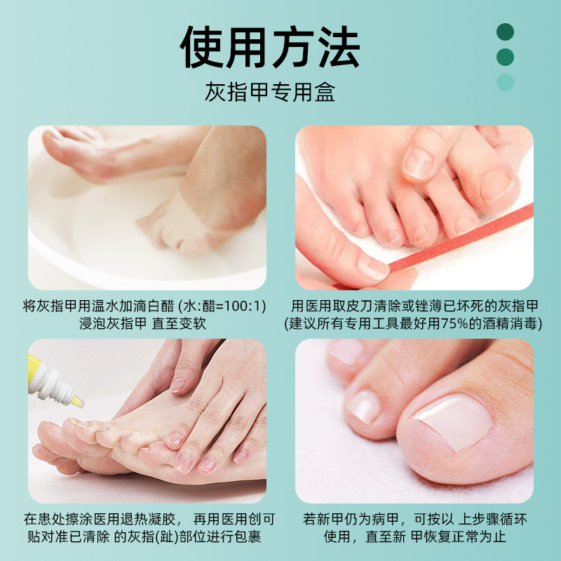 爪真菌症用の Renzhu 特別ボックス、爪真菌症と爪周囲炎のツーインワン ヘルスケア ソリューション キット、爪を厚くして壊れた爪を除去します。|undefined