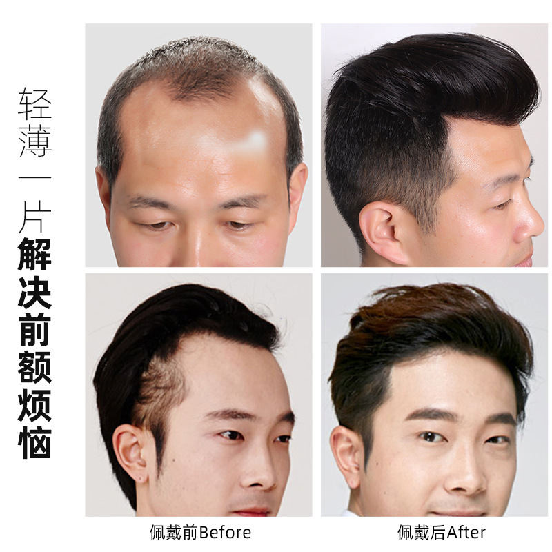 かつらは髪の線の男性の額を貼って、かつらの前髪の真髪の全手織りの見えない額を補充して卸売りします。|undefined