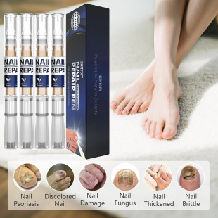 �羳���Nָ������o���Pָ�����Һ���ò����㲿�o�����Bָ�׬F؛