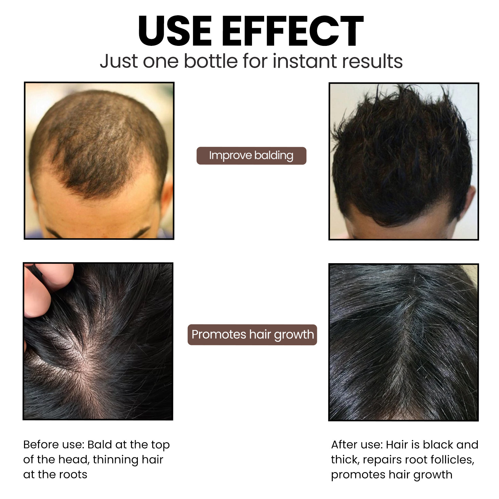Essence Dense EELHOE cheveux Anti chute, raffermissant, nourrissant, renforcement des racines, huile essentielle de soin capillaire_voghion.com