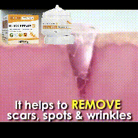 EELHOE Scar Cream Fading Hud Trauma Reparation Forbrænding Forbrænding Fading Cream Kirurgisk reparation Scar Scar Cream_voghion.com