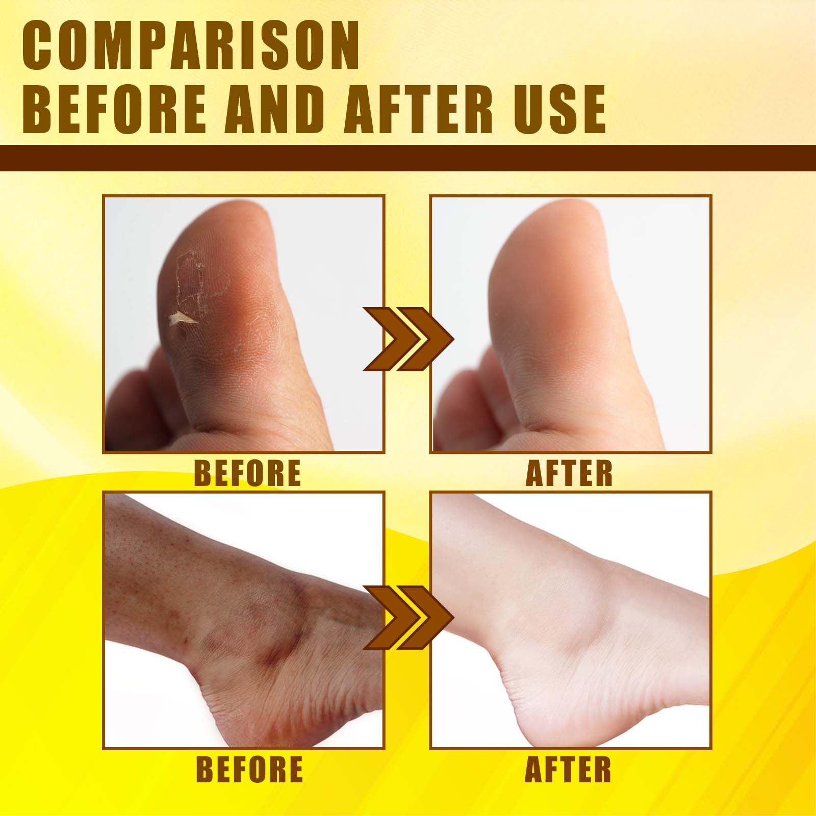 L'huile exfoliante pour la peau jaune Jaysuing hydrate la peau du corps, la rendant délicate, belle, blanche et tendre._voghion.com