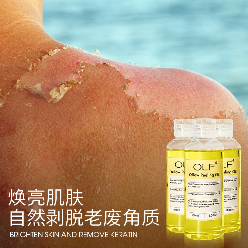 Aceite de peeling amarillo transfronterizo