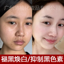 5%氨甲环酸精华液烟酰胺原液高浓度抑制黑色素淡化色斑传明酸原液