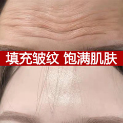 額のしわ、ほうれい線、小じわの除去、くぼみの除去、しわの引き締め、VC 充填パウダー クリーム用のコラーゲン充填パウダー クリーム
