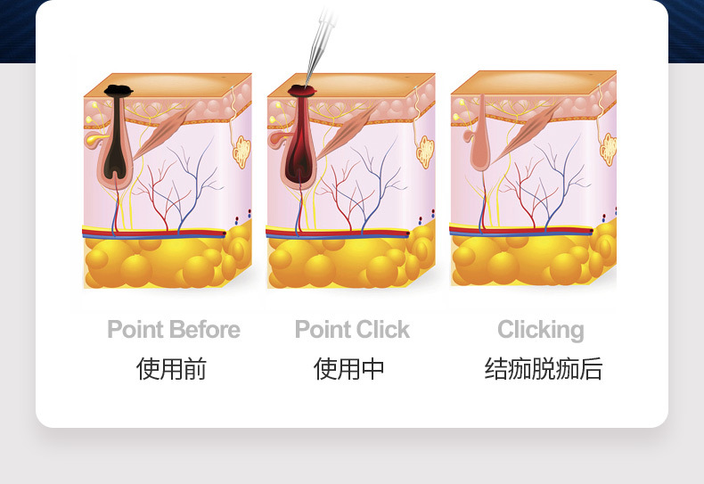 点痣笔详情页_07