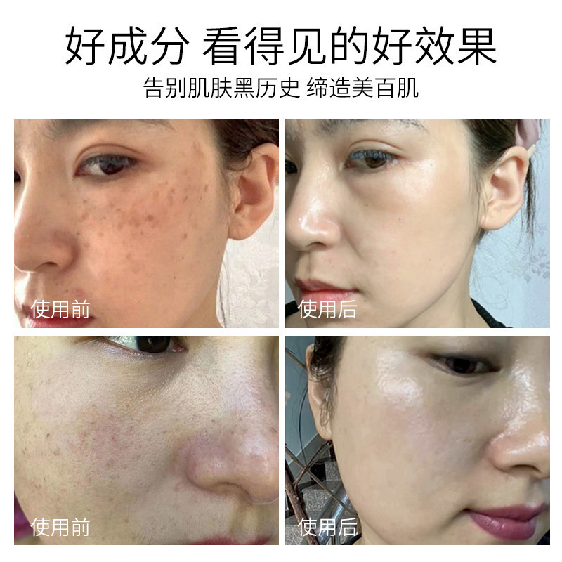 臭臭水は、鉛、水銀、肝斑、色素沈着、メラニンを分解し、肌を明るくします。臭臭水タヒルエッセンスウォーター|undefined