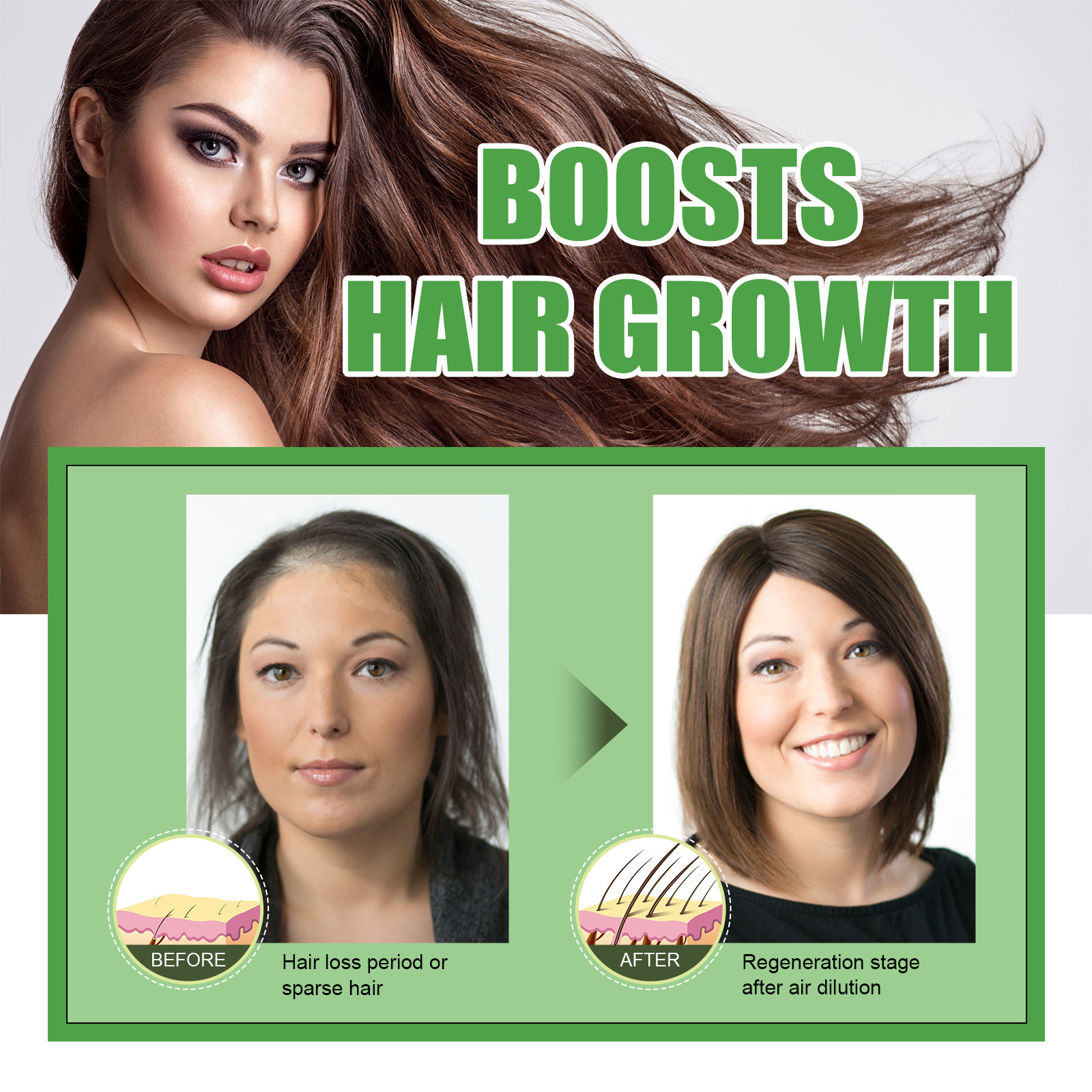 Dense Liquid g spendet Feuchtigkeit, schützt das Haar, beugt Haarausfall vor und festigt es. Black Castor Hair Essence O_voghion.com