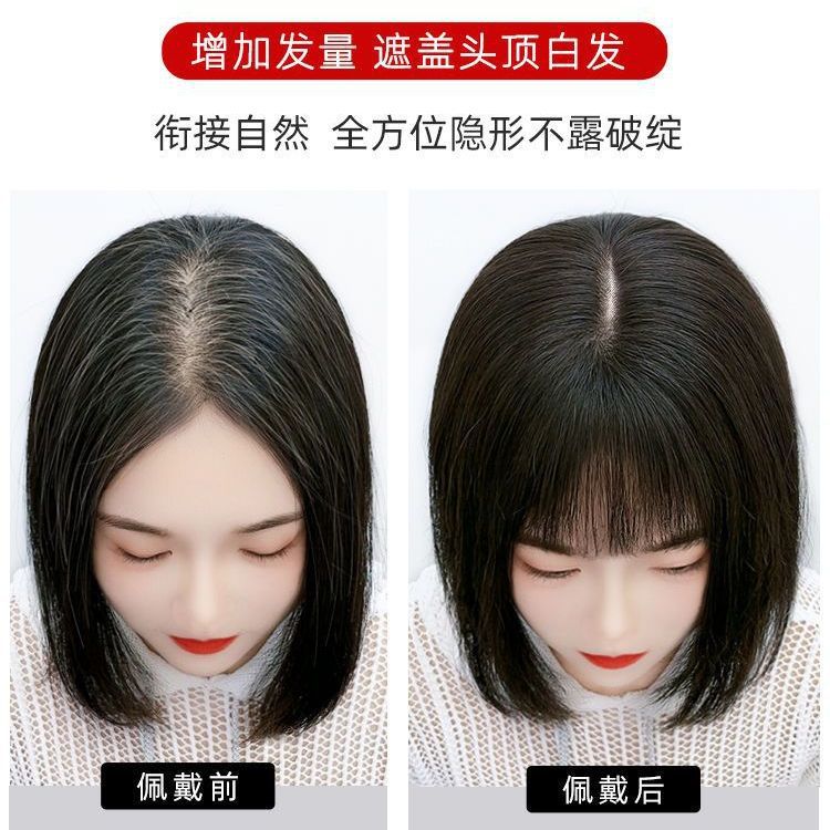 瑞士網假髮片女夏頭頂真發全真仿真補發遮白髮新款蓬鬆增發量假髮