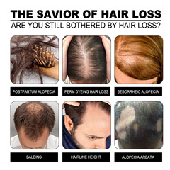 EELHOE 密發洗髮皂 頭髮防掉固發密發柔順修護髮尾乾枯受損洗髮皂