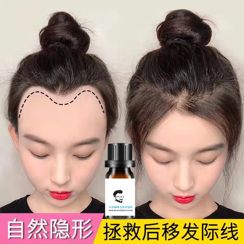 Hairline growth liquid, hair growth liquid, rapid short hair lengthening, anti-hair loss, hair growth liquid, hair growth liquid, hair care essential oil