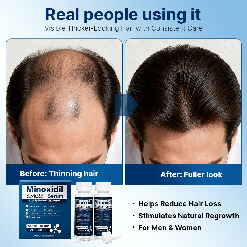 Esencia para Cuero Cabelludo 5% 60ml Reparación Fortalecedor Capilar para Cabello y Cuero Cabelludo image 5