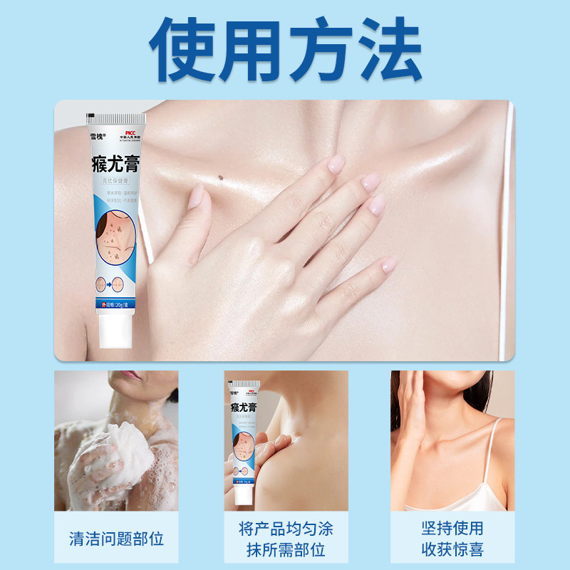 雪槐尤膏草本克のいぼの膏の偏平な足の尤肉のとげの子の肉の粒の尤膏のメーカーの直接販売のいぼの膏|undefined