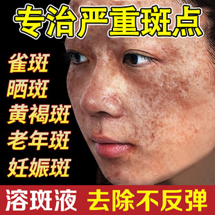 ����Ժ�ܰ�Һ΢������ȡ�������Һ��ɫҺȥȸ����Ƥ����߾��AҺ