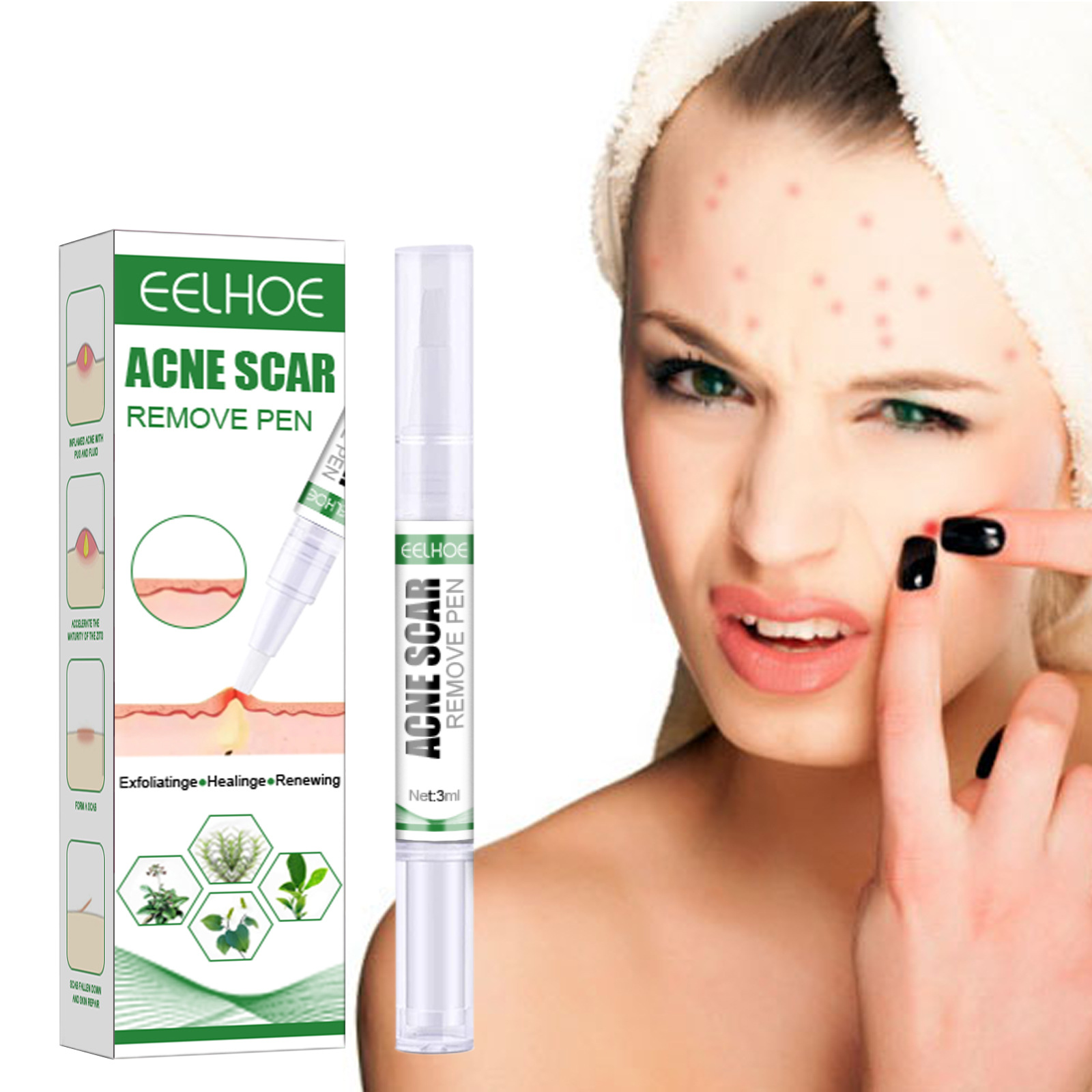 „EELHOE Ac Cleansing Pen“ valomasis pieštukas giliai valo odą, šviesina Ac randus ir atkuria užčiauptos burnos ertmės žaizdas._voghion.com