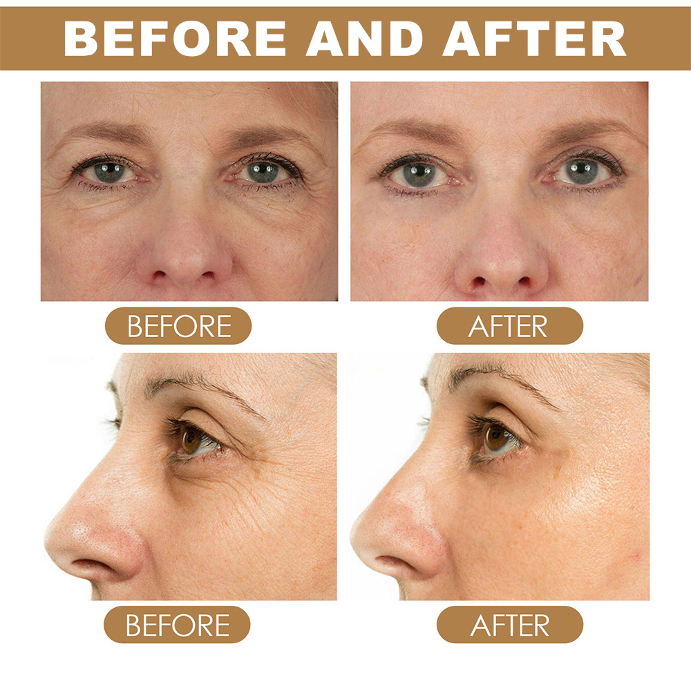 YOUNG VISION Retinol Eye Cream Bar undefined