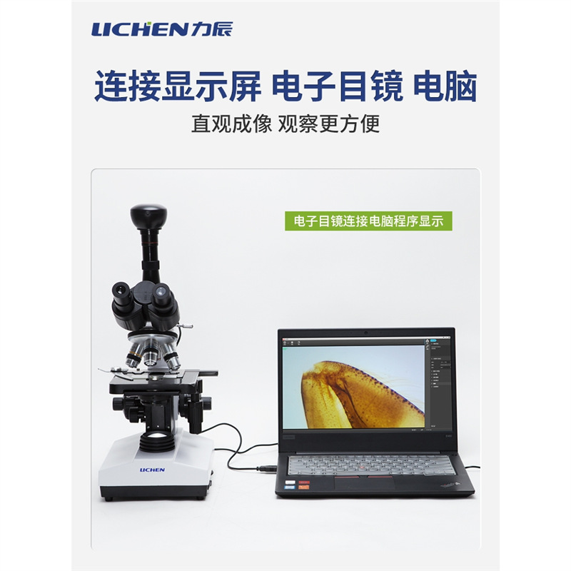 Microscopio biológico profesional LC-XSP - 1CV - 2CAV - 8CA - 02-06 Detector de sangre de una gota de células