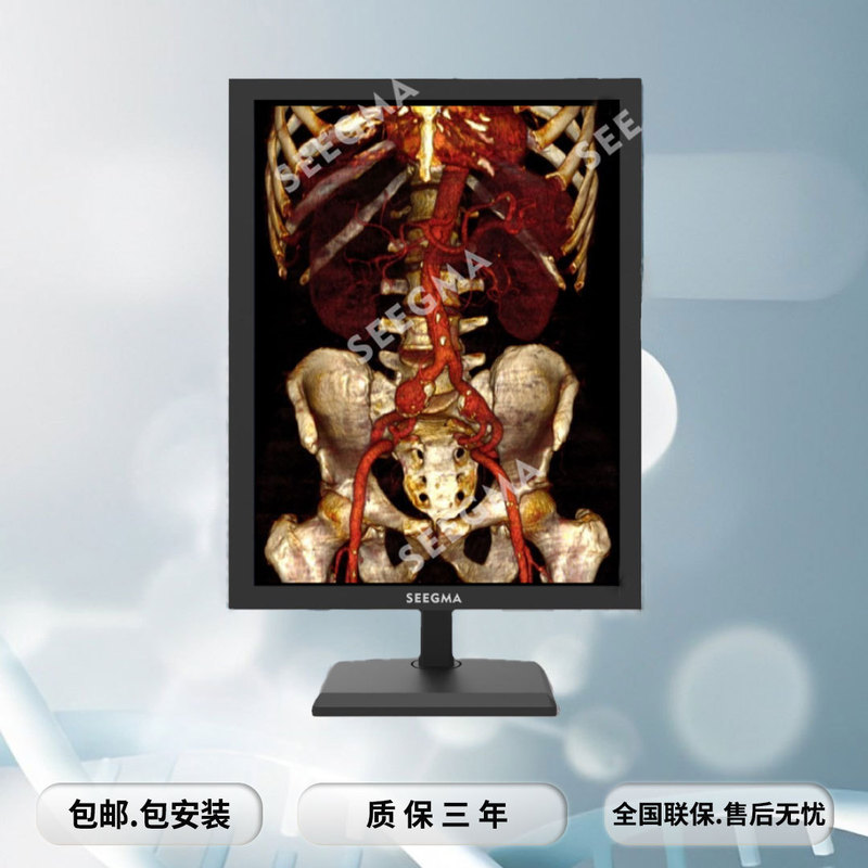3M Color Medical Display Diagnostic CT Vertical Screen Grayscale Medical Display Medical Display 21.3 Inch
