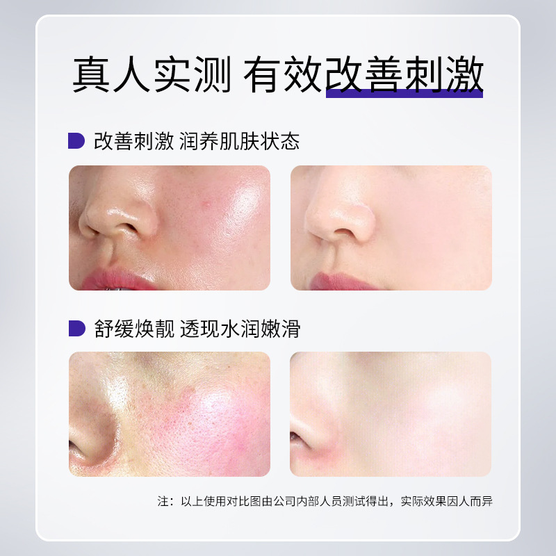 Anchuyt研春堂アンモニア環酸精華液30ml補水コンパクトオイル爽やかスキンケア原液代発|undefined