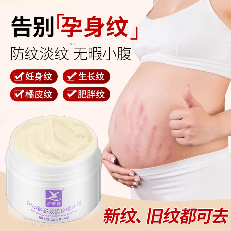 Stretch Wrinkle Removal, Non-Absorbing Growth Marks, Obesity Marks, Covering and Diluting Postpartum Firming Repair Moisturizing Cream Wholesale Stretch Wrinkle Removal, Non-Absorbing Growth Marks, Obesity Marks, Covering and Diluting Postpartum Firming Repair Moisturizing Cream Wholesale