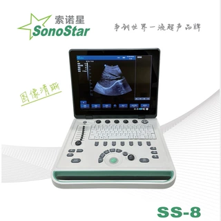 SS-8 全数字便携式超声诊断仪 索诺星厂家黑白医用超声波诊断仪