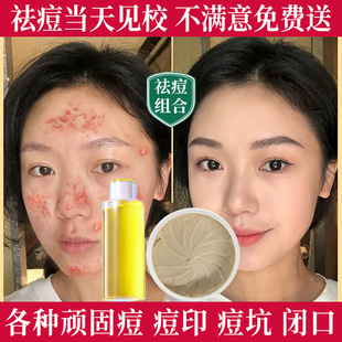 ���a���˪�o�w�ݱ����AҺ��ӡ���]�ڷ۴��B��ȥ�t�[�ഺ��