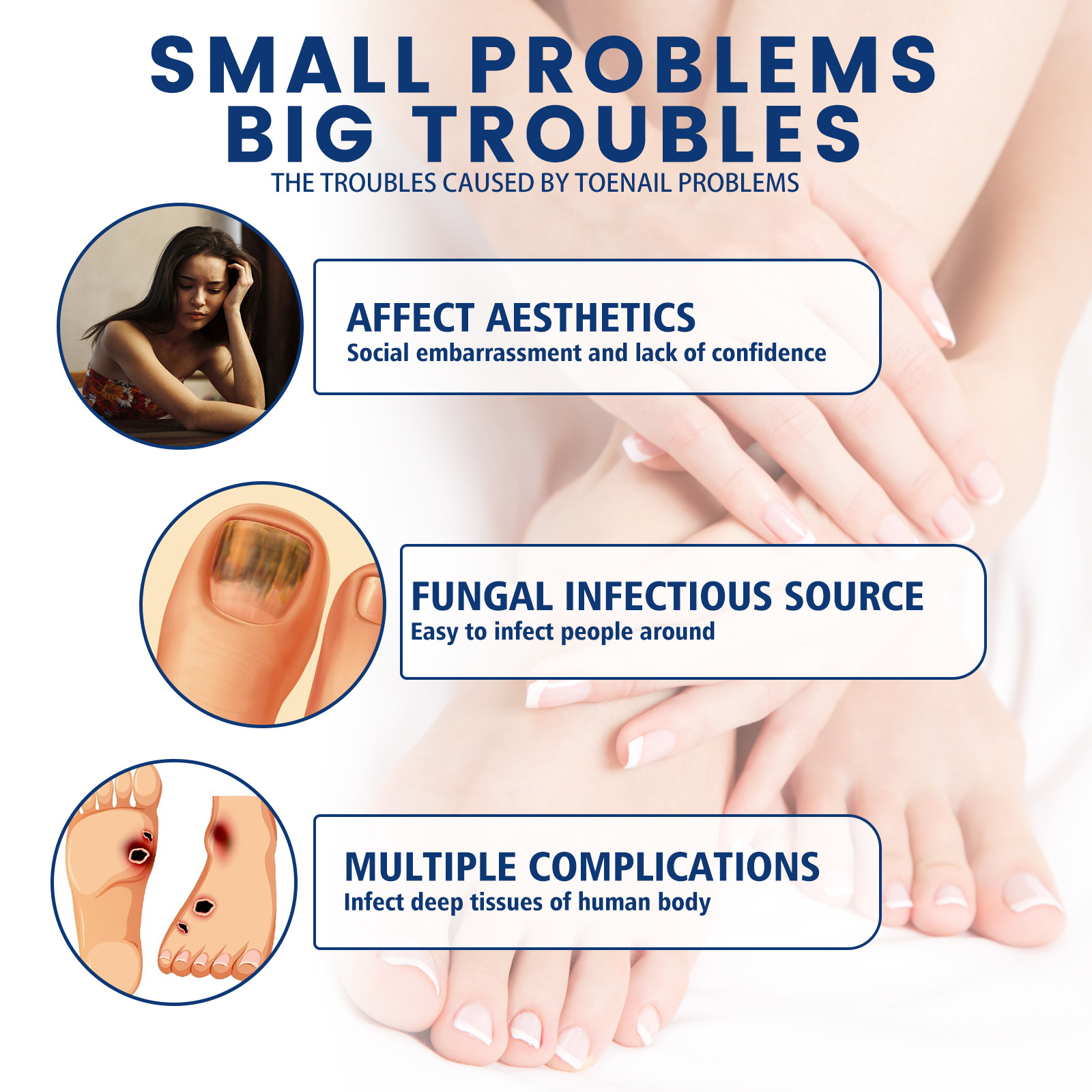 Stylo de réparation South Moon répare les mains et les pieds gris ongles doux brillants épaississement de la Surface des ongles soin hydratant_voghion.com