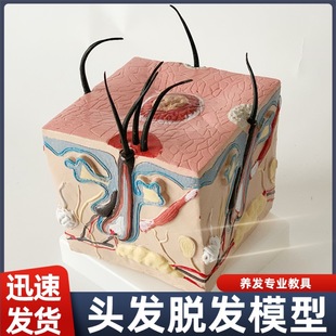 Hair Model hair growth process drop hair loss Human Skin Anatomy enlarged pathology doctor-patient plastic surgery