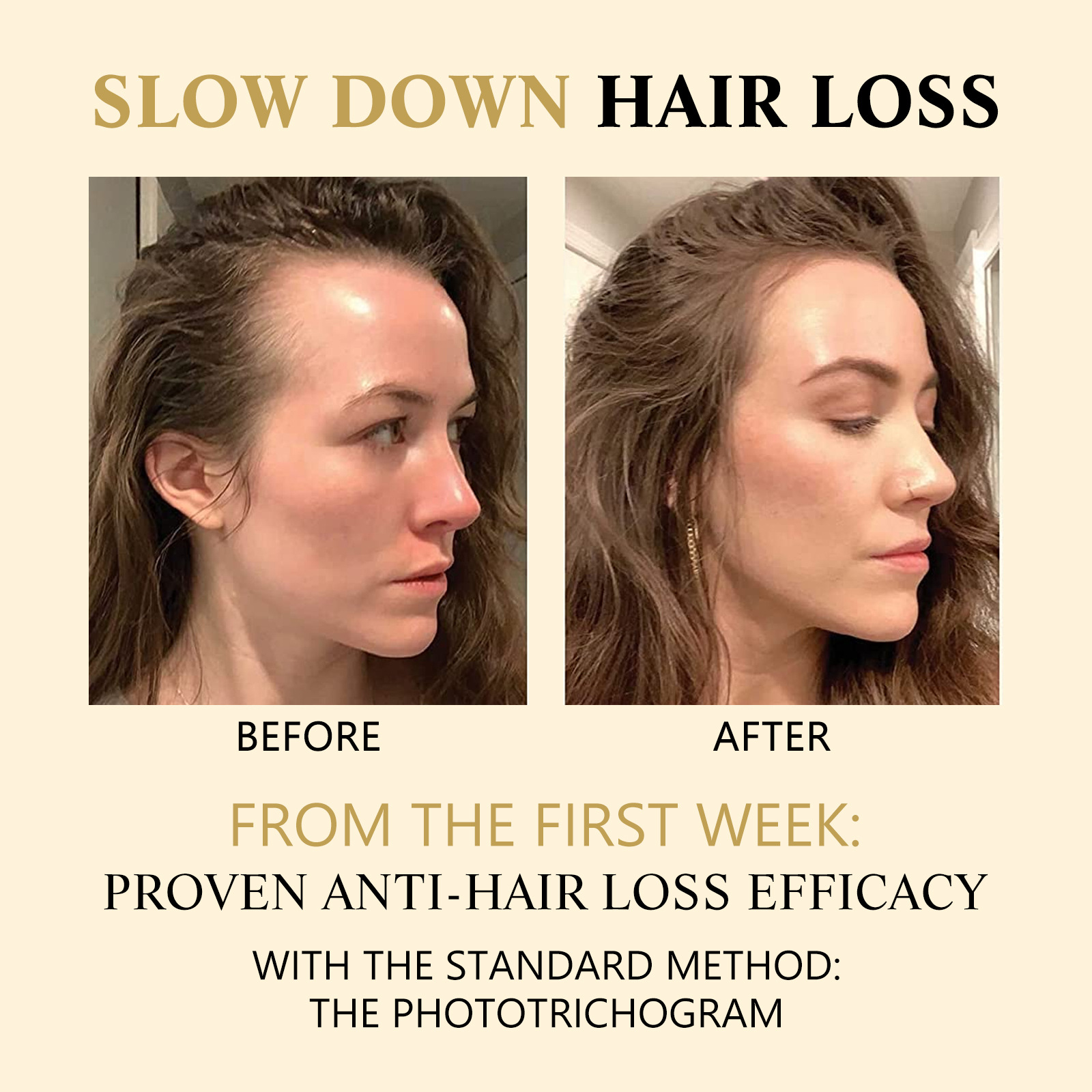 Le massage du cuir chevelu dense West&Month hydrate les racines Boule de soin des cheveux épaisse, douce et lisse_voghion.com