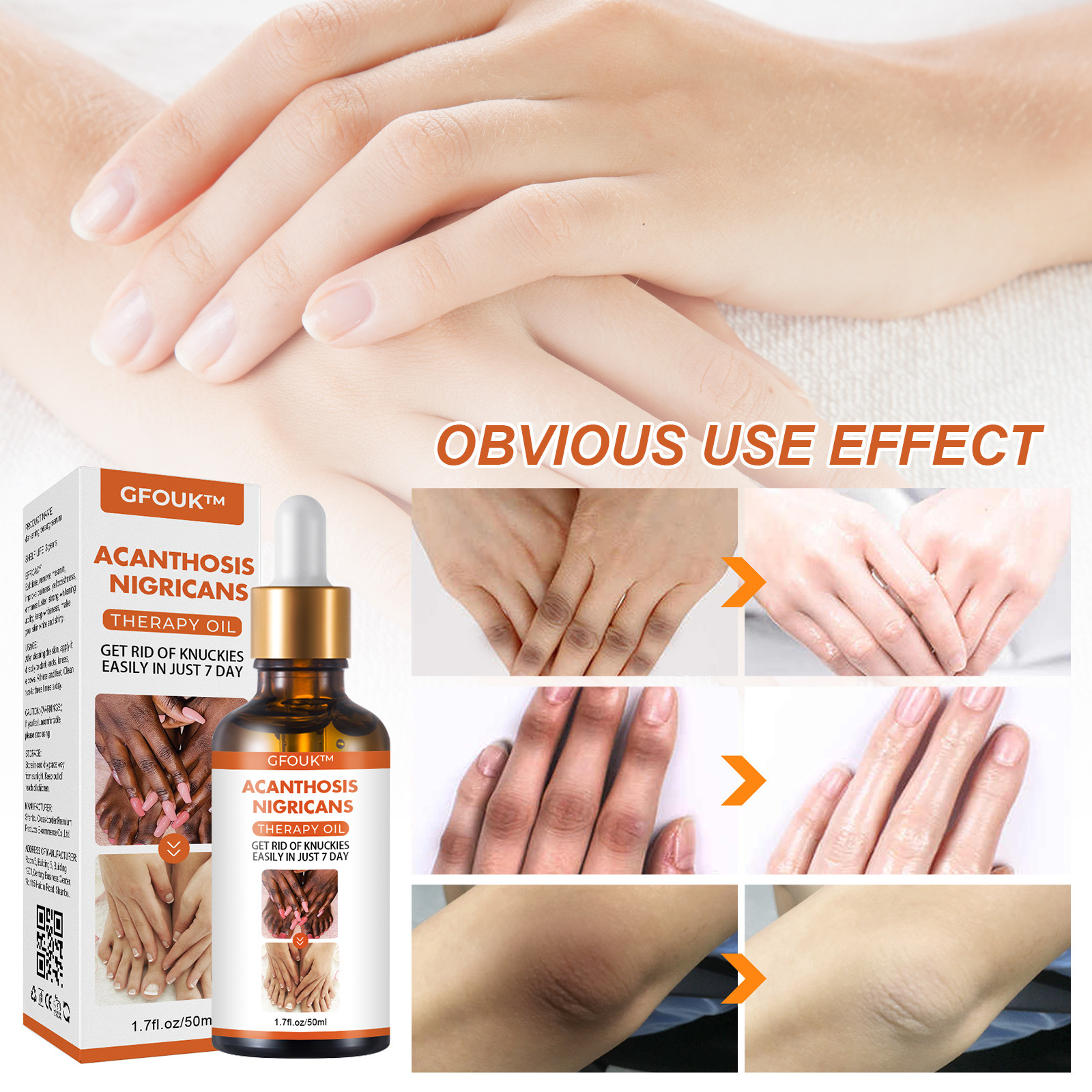 Gelenkverschönernde, feuchtigkeitsspendende und aufhellende, hautreparierende Essenz mit Melanin für Knie- und Sprunggelenke_voghion.com