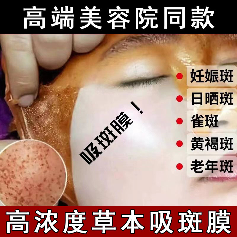 Beauty Salon Spot Suction Film Beauty Whitening and Cleansing Skin Film Tearing Mask to Remove Melanin, Blackhead and acne to Remove Spot