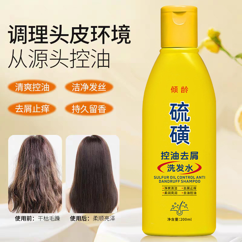 Champú de Azufre para Control de Grasa y Anticaspa para Cabello