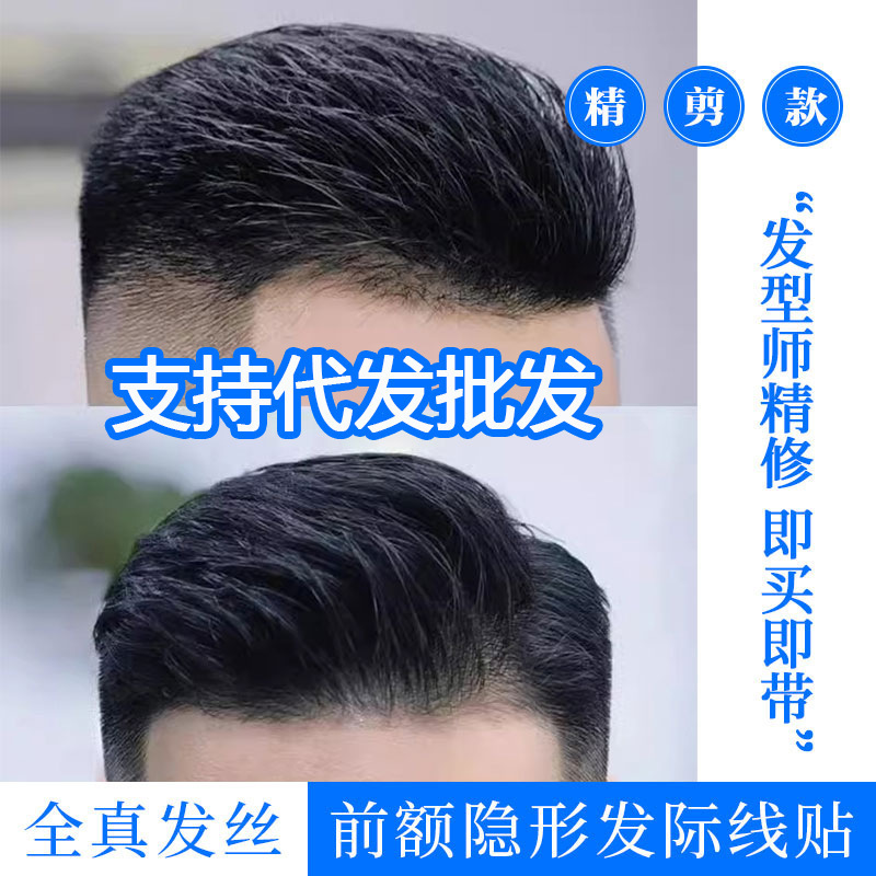 Xuchang Wholesale Hairline Wig Stickers for Men Invisible Traceless Big Back Head Style Forehead Fake Bangs Biological Scalp Full