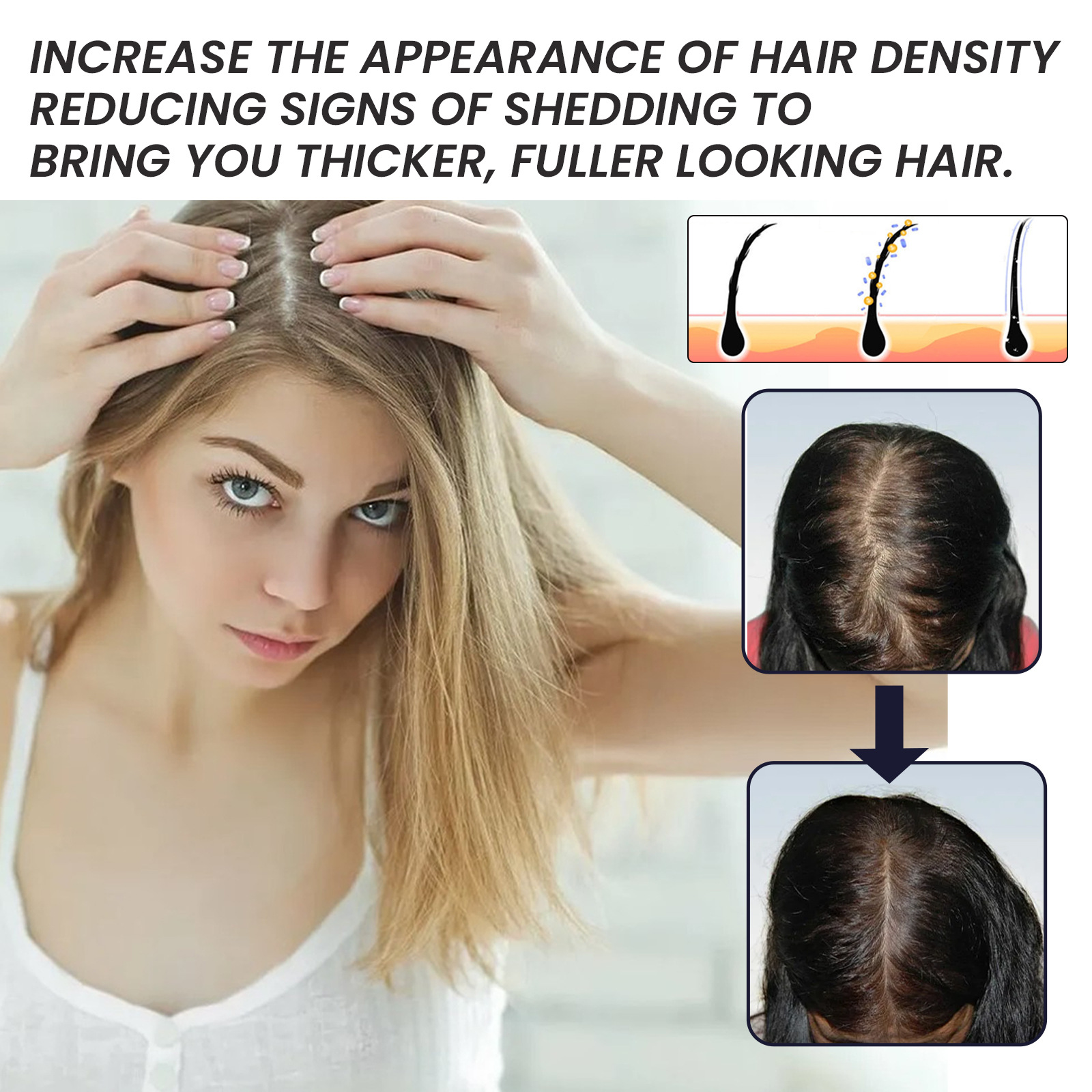 OUHOE Biotin Moisturizing Root Dense Repairing Hairline Strong and Firm Hair Essence_voghion.com