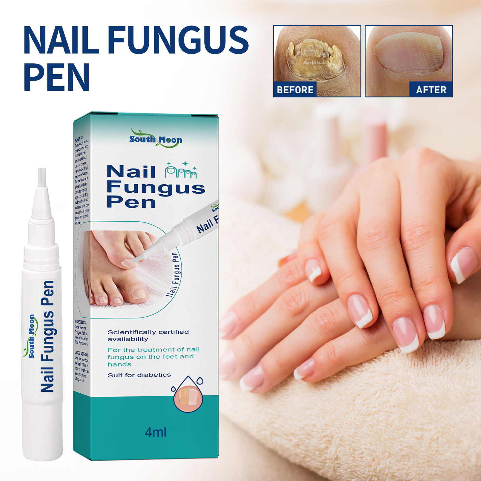Stylo de réparation South Moon répare les mains et les pieds gris ongles doux brillants épaississement de la Surface des ongles soin hydratant_voghion.com
