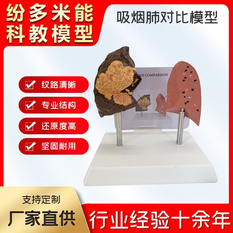 Human Smoking Lung and Healthy Lung Comparison Model, Smoker's Lung ...