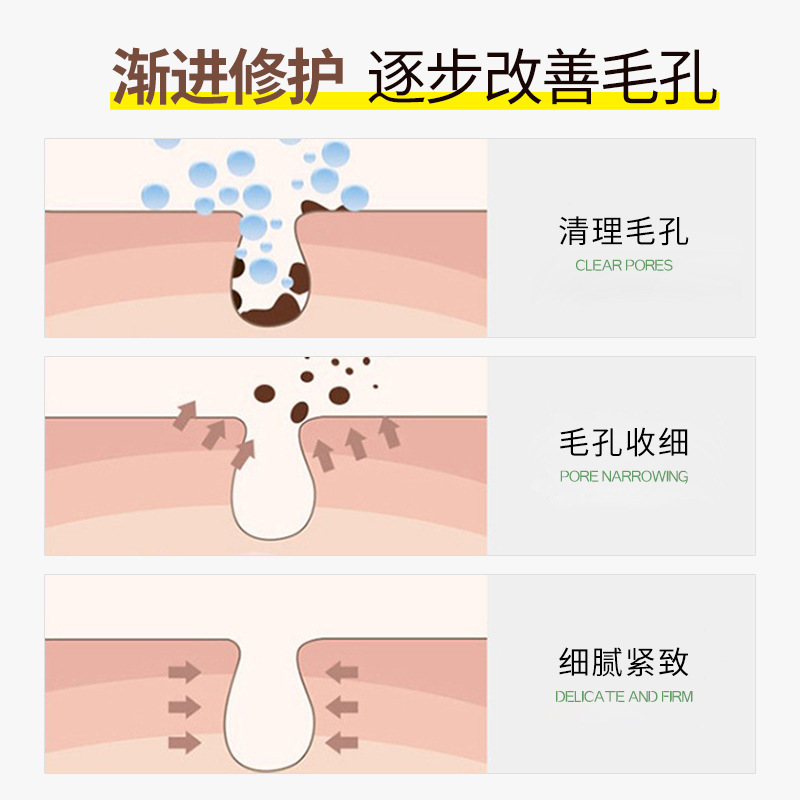 粗大毛穴収縮修復乳酸原液 フルーツ酸サリチル酸毛穴縮小エッセンス液卸売|undefined