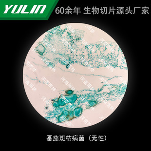 Tomato spot blight bacteria (non-sexual) University Medical College School Histopathology Paraffin Slide Specimen Microscope