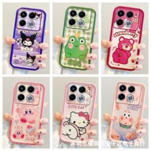 �m��INFINIX CAMON30�֙C��ZERO30��ͨTecno Pova5���L�֙C���o��