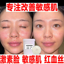 积雪草修护霜去红血丝缓敏感肌增厚角质层补水保湿批发正品美容院