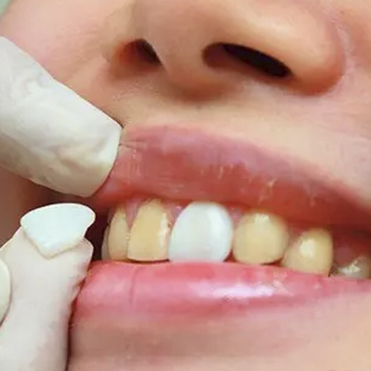 Parche de cerámica sin metal Eyingjia Denberg porcelana azul ámbar Lingxi porcelana hecha a mano sin moler