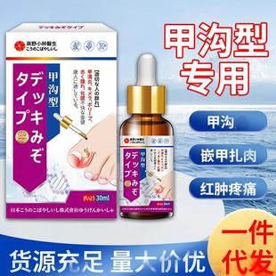 Toenail Redness and Swelling Drops, Nail Groove Swelling and Pain, Ingrown Toenails to Prevent the Flesh of the Flesh, Nail Artifact External Cream