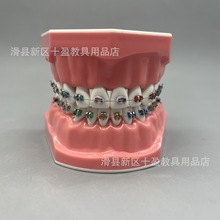 ����ˢ��ָ��ģ�� ���R���� �����p���������C���в��坍 �����z